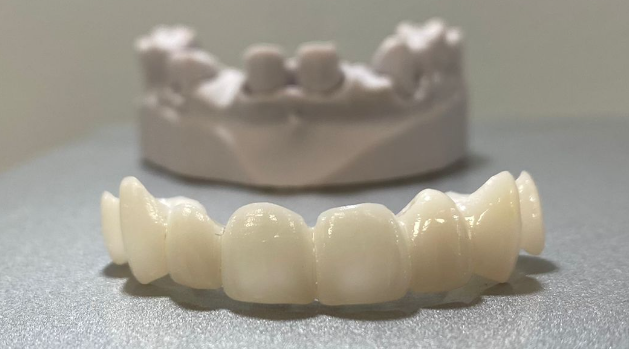 Prosthodontics: crowns, bridges, and restorations for missing teeth